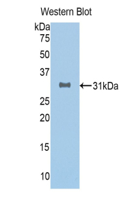 SIRT3 / Sirtuin 3 Antibody - Western blot of recombinant SIRT3 / Sirtuin 3.  This image was taken for the unconjugated form of this product. Other forms have not been tested.