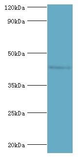 SIRT3 / Sirtuin 3 Antibody - Western blot. All lanes: NAD-dependent protein deacetylase sirtuin-3, mitochondrial antibody at 1 ug/ml+HepG2 whole cell lysate. Secondary antibody: Goat polyclonal to rabbit at 1:10000 dilution. Predicted band size: 44 kDa. Observed band size: 44 kDa Immunohistochemistry.