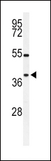 SIRT3 / Sirtuin 3 Antibody - Western blot of SIRT3 antibody in Y79 cell line lysates (35 ug/lane). SIRT3 (arrow) was detected using the purified antibody.