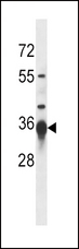 SIRT3 / Sirtuin 3 Antibody - Sirt3 Antibody (G265) western blot of mouse kidney tissue lysates (35 ug/lane). The Sirt3 antibody detected the Sirt3 protein (arrow).