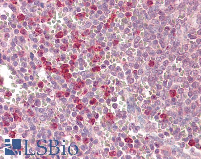 SIRT3 / Sirtuin 3 Antibody - Anti-SIRT3 antibody IHC of human spleen. Immunohistochemistry of formalin-fixed, paraffin-embedded tissue after heat-induced antigen retrieval. Antibody dilution 5-7.5 ug/ml.  This image was taken for the unconjugated form of this product. Other forms have not been tested.