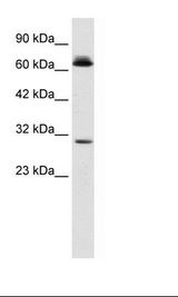 SIRT3 / Sirtuin 3 Antibody - HepG2 Cell Lysate.  This image was taken for the unconjugated form of this product. Other forms have not been tested.