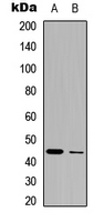 SIRT3 / Sirtuin 3 Antibody - Western blot analysis of SIRT3 expression in HEK293T (A); HepG2 (B) whole cell lysates.