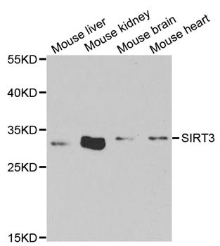 SIRT3 / Sirtuin 3 Antibody - Western blot analysis of extracts of various tissues, using SIRT3 antibody.