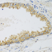 SIRT3 / Sirtuin 3 Antibody - Immunohistochemistry of paraffin-embedded human prostate.