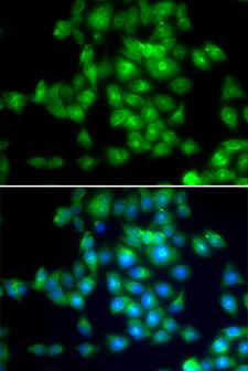 SIRT3 / Sirtuin 3 Antibody - Immunofluorescence analysis of MCF7 cell using SIRT3 antibody. Blue: DAPI for nuclear staining.