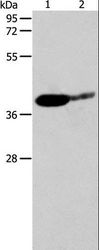 SIRT3 / Sirtuin 3 Antibody - Western blot analysis of Mouse brain and human liver cancer tissue, using SIRT3 Polyclonal Antibody at dilution of 1:500.