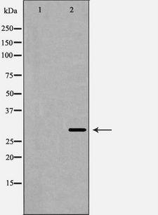 SIRT3 / Sirtuin 3 Antibody - Western blot analysis of SIRT3 expression in mouse Heart lysate. The lane on the left is treated with the antigen-specific peptide.