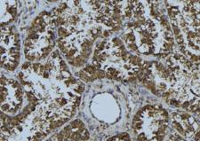 SIRT3 / Sirtuin 3 Antibody - 1:100 staining mouse testis tissue by IHC-P. The sample was formaldehyde fixed and a heat mediated antigen retrieval step in citrate buffer was performed. The sample was then blocked and incubated with the antibody for 1.5 hours at 22°C. An HRP conjugated goat anti-rabbit antibody was used as the secondary.