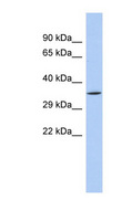 SIRT4 / Sirtuin 4 Antibody - SIRT4 antibody Western blot of Fetal Small Intestine lysate. This image was taken for the unconjugated form of this product. Other forms have not been tested.