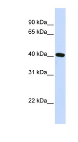 SIRT4 / Sirtuin 4 Antibody - SIRT4 antibody Western blot of Fetal Heart lysate. This image was taken for the unconjugated form of this product. Other forms have not been tested.