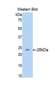 SIRT4 / Sirtuin 4 Antibody - Western blot of recombinant SIRT4 / Sirtuin 4.  This image was taken for the unconjugated form of this product. Other forms have not been tested.