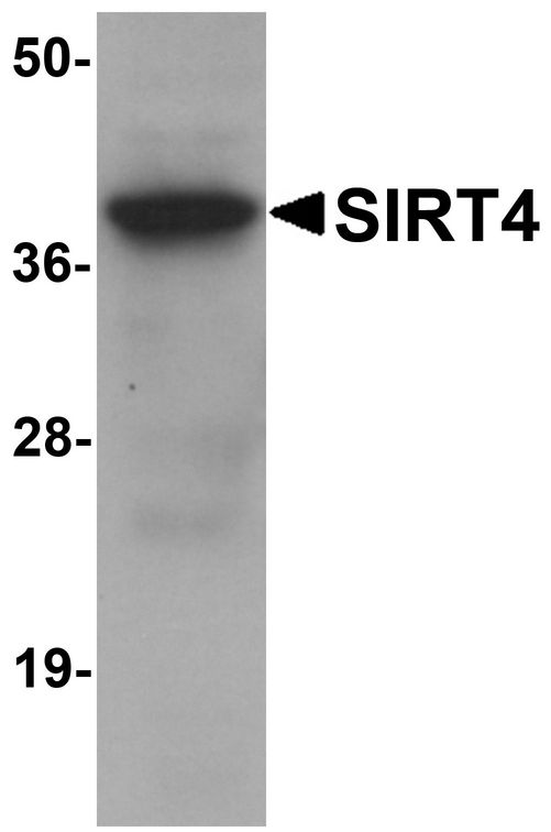 SIRT4 / Sirtuin 4 Antibody - Western blot analysis of SIRT4 in human liver tissue lysate with SIRT4 antibody at 1 ug/ml.