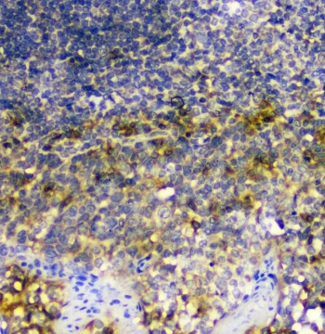 SIRT4 / Sirtuin 4 Antibody - IHC staining of FFPE human tonsil with SIRT4 antibody at 1ug/ml. HIER: boil tissue sections in pH6, 10mM citrate buffer, for 10-20 min and allow to cool before testing.