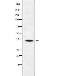 SIRT4 / Sirtuin 4 Antibody - Western blot analysis SIRT4 using Jurkat whole cells lysates
