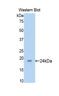 SIRT5 / Sirtuin 5 Antibody - Western blot of recombinant SIRT5 / Sirtuin 5.  This image was taken for the unconjugated form of this product. Other forms have not been tested.