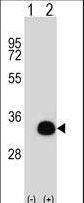 SIRT5 / Sirtuin 5 Antibody - Western blot of SIRT5 (arrow) using rabbit polyclonal SIRT5 Antibody. 293 cell lysates (2 ug/lane) either nontransfected (Lane 1) or transiently transfected (Lane 2) with the SIRT5 gene.