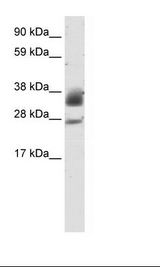SIRT5 / Sirtuin 5 Antibody - Fetal Heart Lysate.  This image was taken for the unconjugated form of this product. Other forms have not been tested.