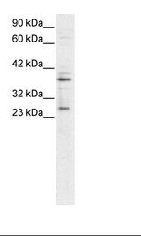 SIRT5 / Sirtuin 5 Antibody - HepG2 Cell Lysate.  This image was taken for the unconjugated form of this product. Other forms have not been tested.