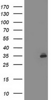 SIRT5 / Sirtuin 5 Antibody - HEK293T cells were transfected with the pCMV6-ENTRY control (Left lane) or pCMV6-ENTRY SIRT5 (Right lane) cDNA for 48 hrs and lysed. Equivalent amounts of cell lysates (5 ug per lane) were separated by SDS-PAGE and immunoblotted with anti-SIRT5.