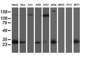 SIRT5 / Sirtuin 5 Antibody - Western blot of extracts (35 ug) from 9 different cell lines by using anti-SIRT5 monoclonal antibody.