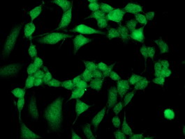 SIRT5 / Sirtuin 5 Antibody - Immunofluorescent staining of HeLa cells using anti-SIRT5 mouse monoclonal antibody.