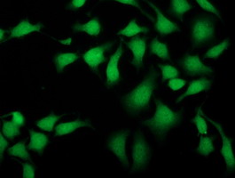 SIRT5 / Sirtuin 5 Antibody - Immunofluorescent staining of HeLa cells using anti-SIRT5 mouse monoclonal antibody.