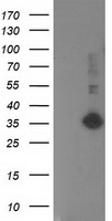 SIRT5 / Sirtuin 5 Antibody - HEK293T cells were transfected with the pCMV6-ENTRY control (Left lane) or pCMV6-ENTRY SIRT5 (Right lane) cDNA for 48 hrs and lysed. Equivalent amounts of cell lysates (5 ug per lane) were separated by SDS-PAGE and immunoblotted with anti-SIRT5.