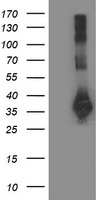 SIRT5 / Sirtuin 5 Antibody - HEK293T cells were transfected with the pCMV6-ENTRY control (Left lane) or pCMV6-ENTRY SIRT5 (Right lane) cDNA for 48 hrs and lysed. Equivalent amounts of cell lysates (5 ug per lane) were separated by SDS-PAGE and immunoblotted with anti-SIRT5.