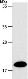 SIRT5 / Sirtuin 5 Antibody - Western blot analysis of Mouse heart tissue, using SIRT5 Polyclonal Antibody at dilution of 1:500.