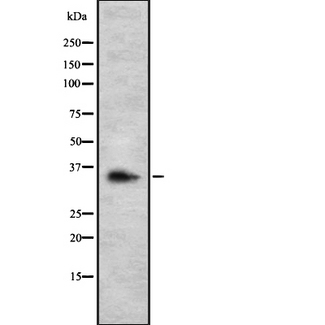 SIRT5 / Sirtuin 5 Antibody - Western blot analysis SIRT5 using Jurkat whole cells lysates
