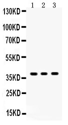 SIRT6 / Sirtuin 6 Antibody - SIRT6 antibody Western blot. All lanes: Anti SIRT6 at 0.5 ug/ml. Lane 1: HELA Whole Cell Lysate at 40 ug. Lane 2: A549 Whole Cell Lysate at 40 ug. Lane 3: Human Placenta Tissue Lysate at 50 ug. Predicted band size: 39 kD. Observed band size: 39 kD.