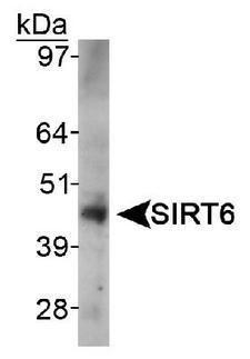 SIRT6 / Sirtuin 6 Antibody - Detection of SIRT6 in HeLa whole cell lysate.  This image was taken for the unconjugated form of this product. Other forms have not been tested.