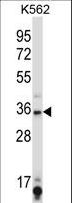 SIRT6 / Sirtuin 6 Antibody - SIRT6 Antibody western blot of K562 cell line lysates (35 ug/lane). The SIRT6 antibody detected the SIRT6 protein (arrow).