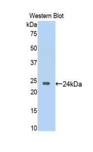 SIRT6 / Sirtuin 6 Antibody - Western blot of recombinant SIRT6 / Sirtuin 6.  This image was taken for the unconjugated form of this product. Other forms have not been tested.