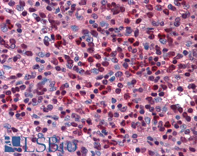 SIRT6 / Sirtuin 6 Antibody - Anti-SIRT6 antibody IHC of human spleen. Immunohistochemistry of formalin-fixed, paraffin-embedded tissue after heat-induced antigen retrieval. Antibody concentration 5 ug/ml.  This image was taken for the unconjugated form of this product. Other forms have not been tested.