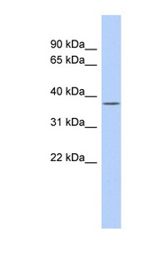 SIRT6 / Sirtuin 6 Antibody - SIRT6 antibody Western blot of Fetal Spleen lysate. This image was taken for the unconjugated form of this product. Other forms have not been tested.