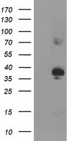 SIRT6 / Sirtuin 6 Antibody - HEK293T cells were transfected with the pCMV6-ENTRY control (Left lane) or pCMV6-ENTRY SIRT6 (Right lane) cDNA for 48 hrs and lysed. Equivalent amounts of cell lysates (5 ug per lane) were separated by SDS-PAGE and immunoblotted with anti-SIRT6.