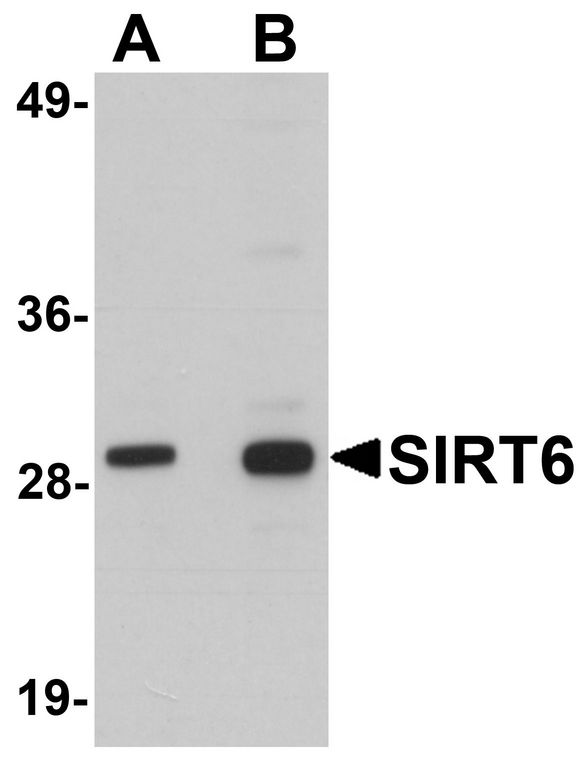 SIRT6 / Sirtuin 6 Antibody - Western blot analysis of SIRT6 in HeLa cell lysate with SIRT6 antibody at (A) 0.5 and (B) 1 ug/ml.