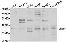 SIRT6 / Sirtuin 6 Antibody - Western blot analysis of extracts of various cell lines.