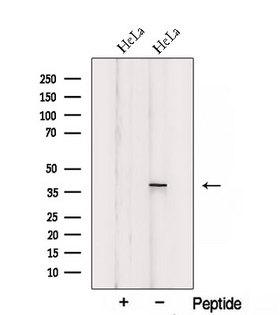 SIRT6 / Sirtuin 6 Antibody - Western blot analysis of extracts of HeLa cells using SIRT6 antibody. The lane on the left was treated with blocking peptide.