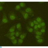 SIRT6 / Sirtuin 6 Antibody - Immunofluorescent analysis of Hela cells fixed by 4% paraformaldehyde and using SIRT6 mouse mAb (dilution 1:100).