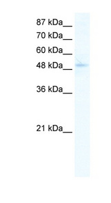 SIRT7 / Sirtuin 7 Antibody - SIRT7 antibody Western blot of Jurkat lysate. This image was taken for the unconjugated form of this product. Other forms have not been tested.