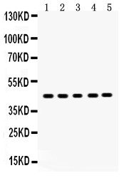 SIRT7 / Sirtuin 7 Antibody - SIRT7 antibody Western blot. All lanes: Anti SIRT7 at 0.5 ug/ml. Lane 1: Rat Spleen Tissue Lysate at 50 ug. Lane 2: Rat Brain Tissue Lysate at 50 ug. Lane 3: Rat Intestine Tissue Lysate at 50 ug. Lane 4: SMMC Whole Cell Lysate at 40 ug. Lane 5: JURKAT Whole Cell Lysate at 40 ug. Predicted band size: 45 kD. Observed band size: 45 kD.