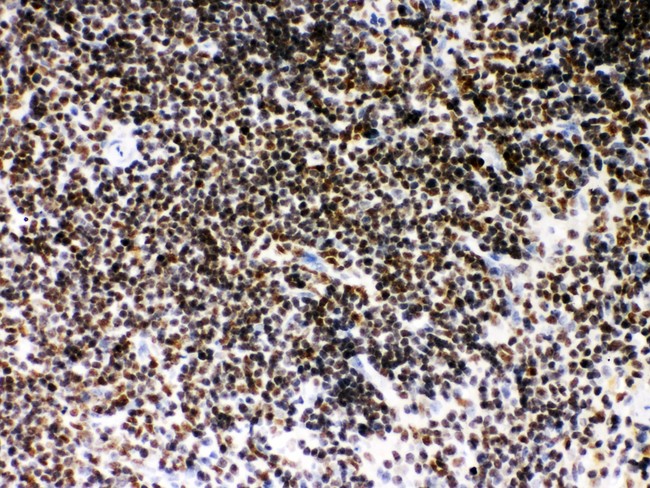 SIRT7 / Sirtuin 7 Antibody - SIRT7 antibody IHC-paraffin: Mouse Spleen Tissue.