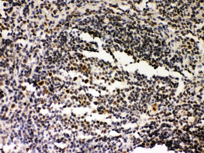 SIRT7 / Sirtuin 7 Antibody - SIRT7 antibody IHC-paraffin: Rat Spleen Tissue.