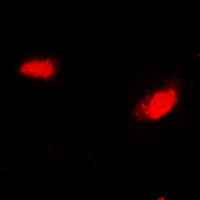 SIRT7 / Sirtuin 7 Antibody - Immunofluorescent analysis of SIRT7 staining in HeLa cells. Formalin-fixed cells were permeabilized with 0.1% Triton X-100 in TBS for 5-10 minutes and blocked with 3% BSA-PBS for 30 minutes at room temperature. Cells were probed with the primary antibody in 3% BSA-PBS and incubated overnight at 4 deg C in a humidified chamber. Cells were washed with PBST and incubated with a DyLight 594-conjugated secondary antibody (red) in PBS at room temperature in the dark.