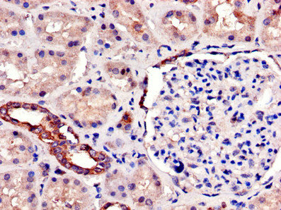 SIRT7 / Sirtuin 7 Antibody - Immunohistochemistry of paraffin-embedded human kidney tissue using SIRT7 Antibody at dilution of 1:100