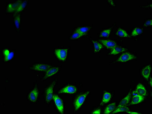 SIRT7 / Sirtuin 7 Antibody - Immunofluorescent analysis of Hela cells using SIRT7 Antibody at a dilution of 1:100 and Alexa Fluor 488-congugated AffiniPure Goat Anti-Rabbit IgG(H+L)