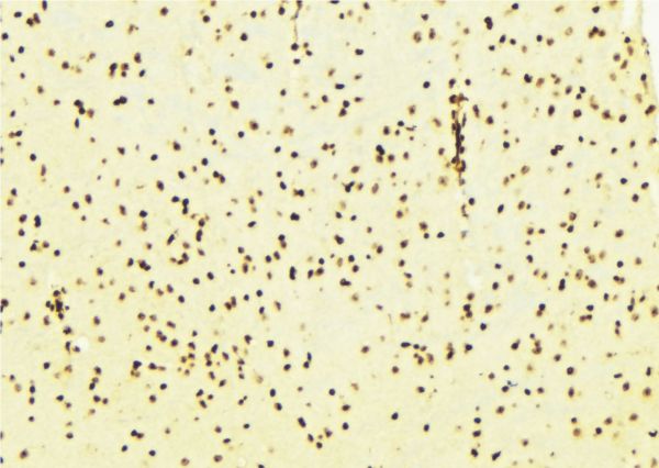 SIRT7 / Sirtuin 7 Antibody - 1:100 staining mouse brain tissue by IHC-P. The sample was formaldehyde fixed and a heat mediated antigen retrieval step in citrate buffer was performed. The sample was then blocked and incubated with the antibody for 1.5 hours at 22°C. An HRP conjugated goat anti-rabbit antibody was used as the secondary.